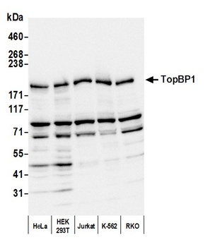 TopBP1 Antibody