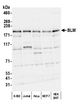 Rabbit anti-BLM Antibody