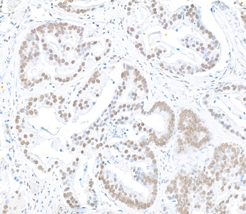 Rabbit anti-RbBP5 Antibody