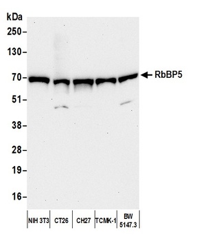 Rabbit anti-RbBP5 Antibody