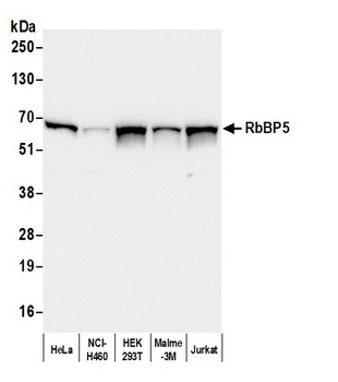 Rabbit anti-RbBP5 Antibody