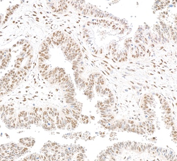 Rabbit anti-RbBP5 Antibody