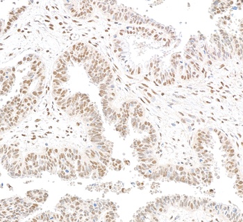 RbBP5 Antibody