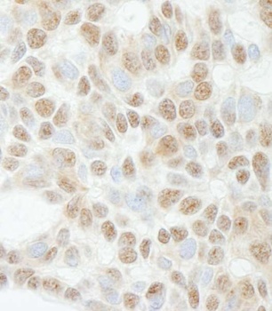 Rabbit anti-ADNP Antibody