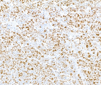 Rabbit anti-Phospho MCM2 (S108) Antibody