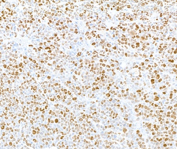 MCM2, Phospho (S108) Antibody