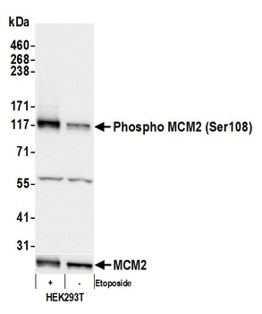 Rabbit anti-Phospho MCM2 (S108) Antibody