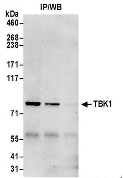 Rabbit anti-TBK1 Antibody