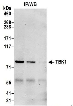 TBK1 Antibody