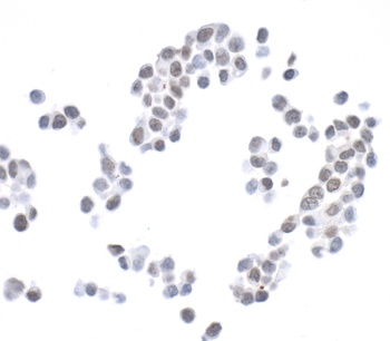 Rabbit H2AX Antibody