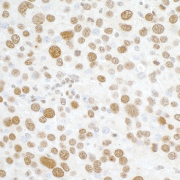 Rabbit H2AX Antibody