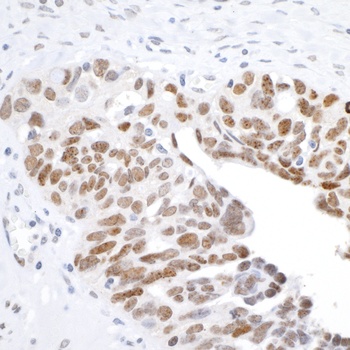 Rabbit H2AX Antibody
