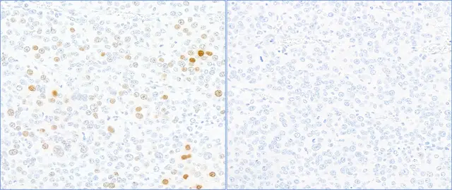 Rabbit gamma-H2AX Antibody
