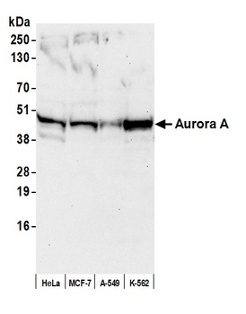 Rabbit Aurora A Antibody