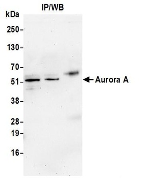 Rabbit Aurora A Antibody