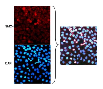 Rabbit anti-SMC4 Antibody