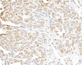 Rabbit anti-SMC3 Antibody