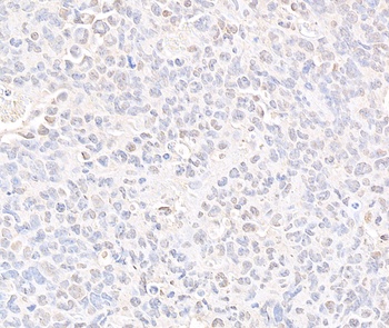 Rabbit anti-SMC3 Antibody
