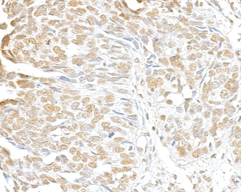 SMC3 Antibody