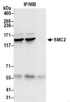 Rabbit anti-SMC2 Antibody