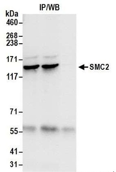 SMC2 Antibody