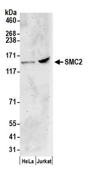 Rabbit anti-SMC2 Antibody