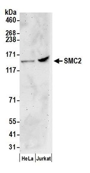 SMC2 Antibody