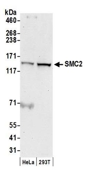Rabbit anti-SMC2 Antibody