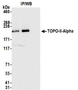 Topo II Alpha Antibody