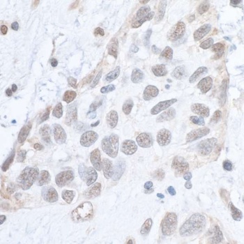 Rabbit anti-Phospho SMC1 (S966) Antibody