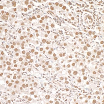 Rabbit anti-Phospho SMC1 (S966) Antibody