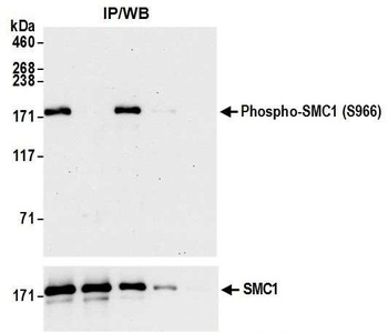 Rabbit anti-Phospho SMC1 (S966) Antibody