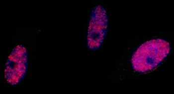 SMC1, Phospho (S966) Antibody