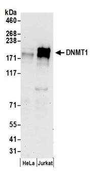 Rabbit anti-DNMT1 Antibody