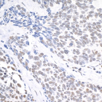 Rabbit anti-USP7 Antibody