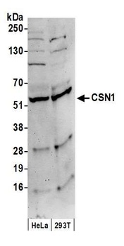 Rabbit anti-CSN1 Antibody