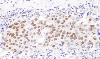 Rabbit anti-GTF2I/TFII-I Antibody