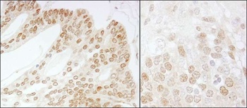 Rabbit CSN5 Antibody