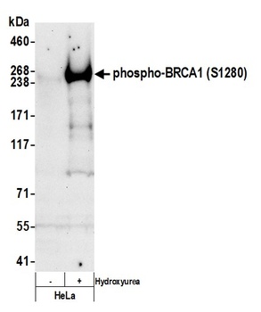 Rabbit anti-Phospho BRCA1 (S1280) Antibody
