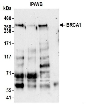 Rabbit BRCA1 Antibody