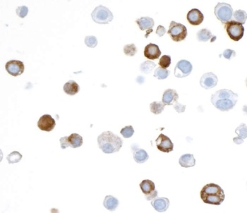 Rabbit anti-V5 Tag Recombinant Monoclonal Antibody