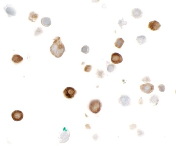 Rabbit anti-HA Tag Recombinant Monoclonal Antibody
