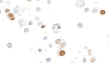 Rabbit anti-HA Tag Recombinant Monoclonal Antibody