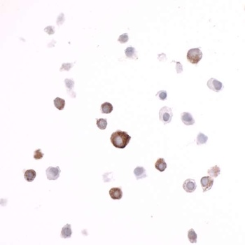 Rabbit anti-ECS (DYKDDDDK) Tag Recombinant Monoclonal Antibody