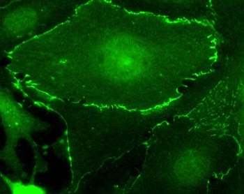 Rabbit Myc Tag Antibody