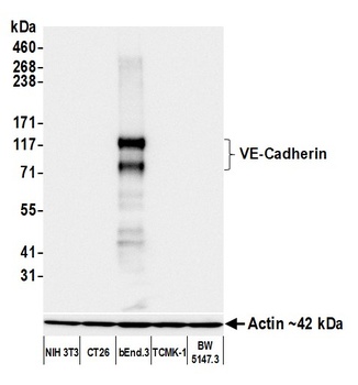 Rabbit anti-VE-Cadherin Recombinant Monoclonal Antibody