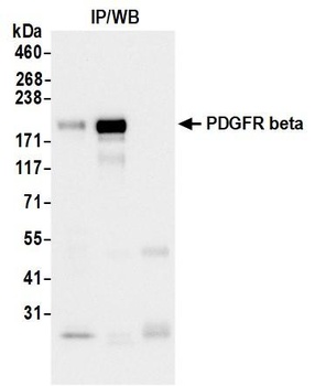 PDGFR beta Antibody