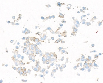 Rabbit anti-PDGFR beta Recombinant Monoclonal Antibody