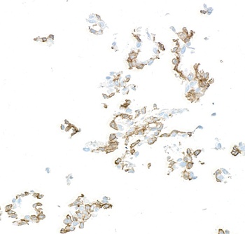 Rabbit anti-PDGFR beta Recombinant Monoclonal Antibody