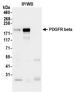 Rabbit anti-PDGFR beta Recombinant Monoclonal Antibody